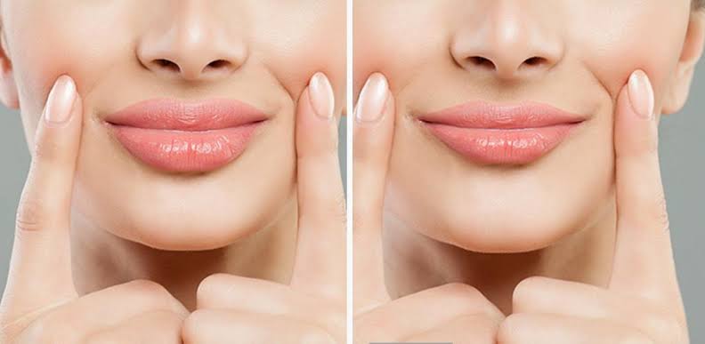 حمض الهيالورونيك